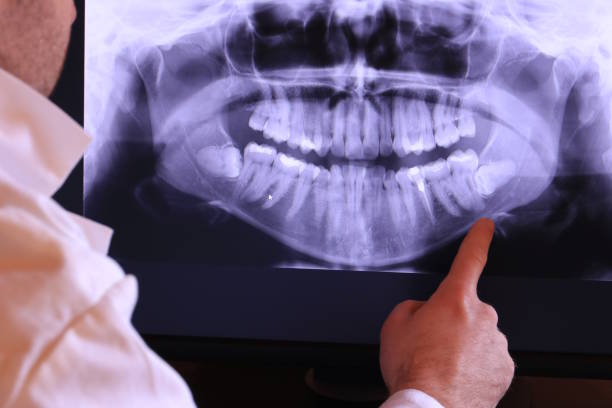Best Emergency Cosmetic Dentistry in Burley, WA
