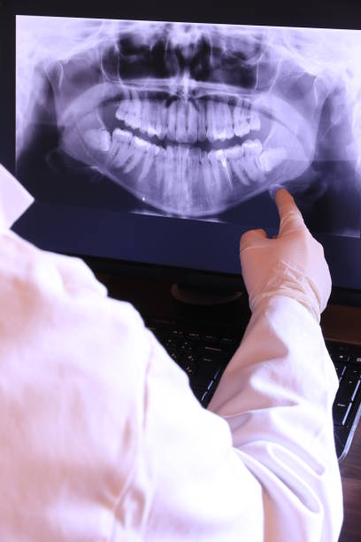 Best Emergency Dentist for Lost Fillings or Crowns in Burley, WA
