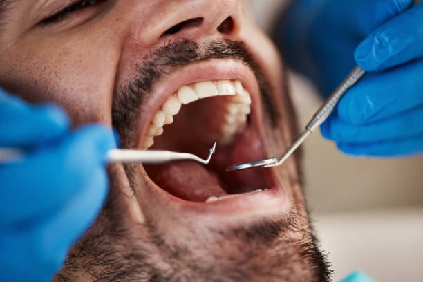 Best Emergency Cosmetic Dentistry in Burley, WA